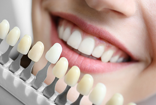 Keith A. Kye, DDS, FAGD