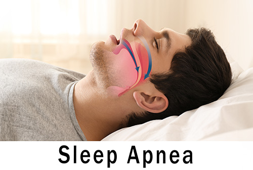 Keith A. Kye, DDS, FAGD